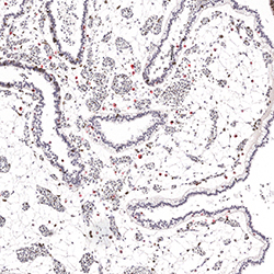 CS23 immunohistochemistry