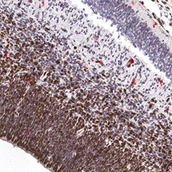 CS23 immunohistochemistry