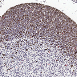 CS12 immunohistochemistry
