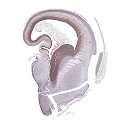 10pcw immunohistochemistry
