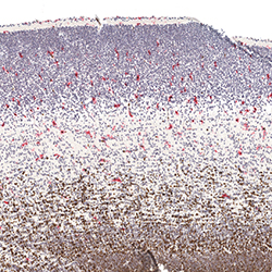 12pcw immunohistochemistry