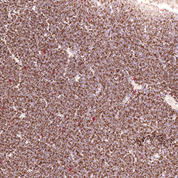 12pcw immunohistochemistry