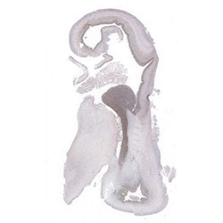 12pcw immunohistochemistry