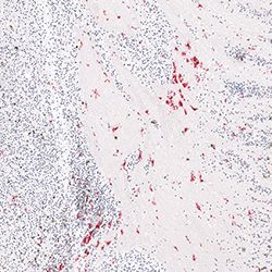 12pcw immunohistochemistry