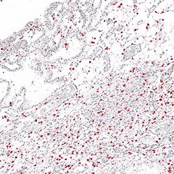 12pcw immunohistochemistry