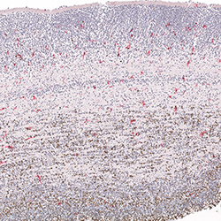 12pcw immunohistochemistry