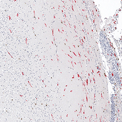 12pcw immunohistochemistry