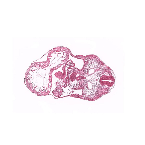 A histology section of a human embryo