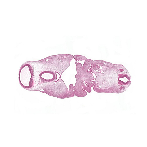 A histology section of a human embryo