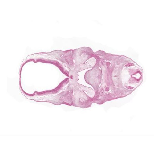 A histology section of a human embryo