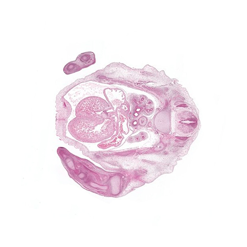 A histology section of a human embryo