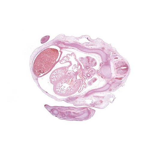 A histology section of a human embryo