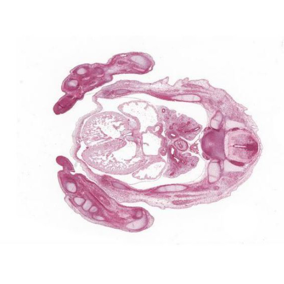 A histology section of a human embryo