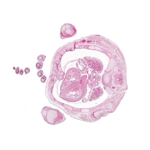 A histology section of a human embryo