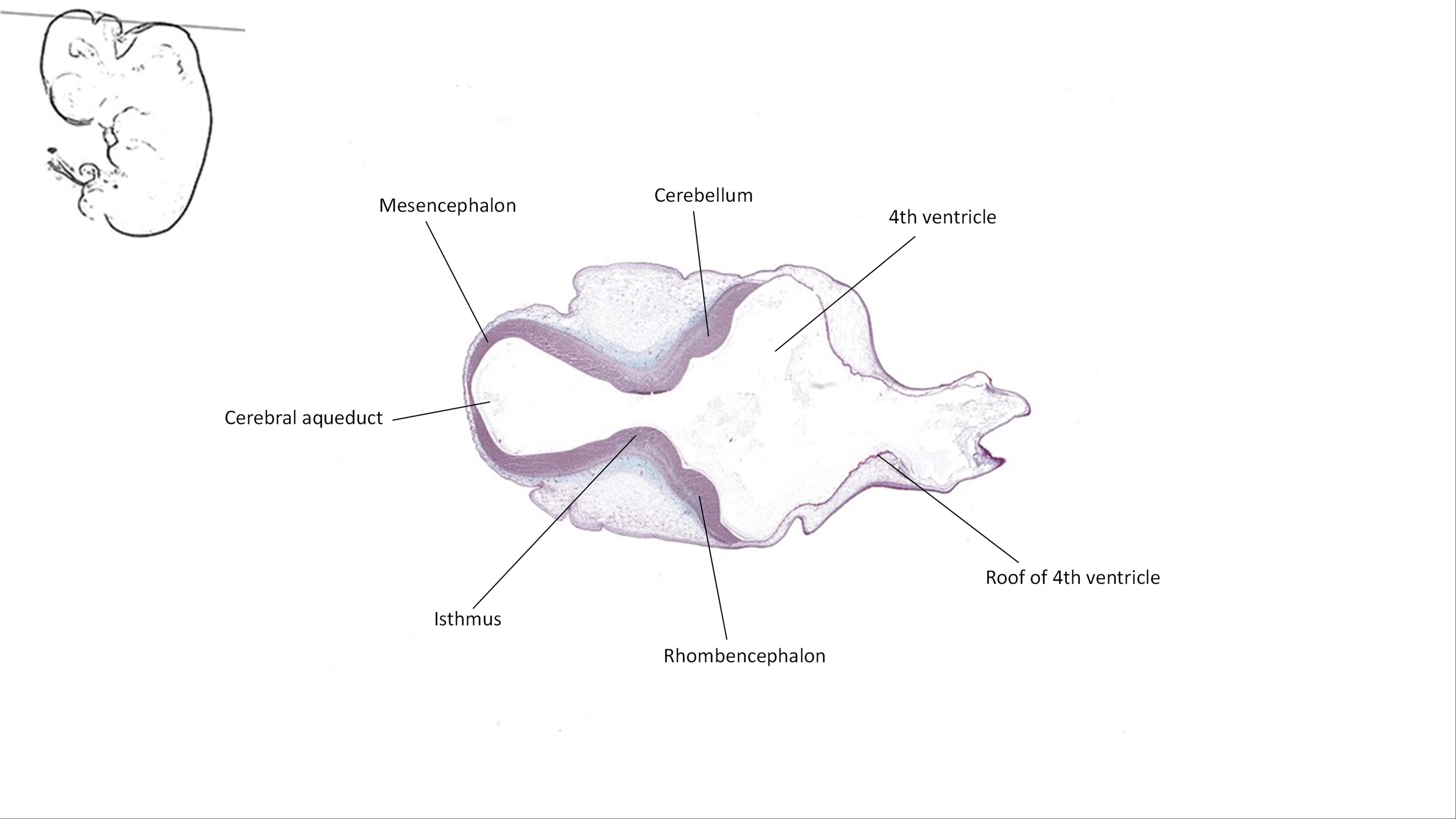 A histology section of a human embryo