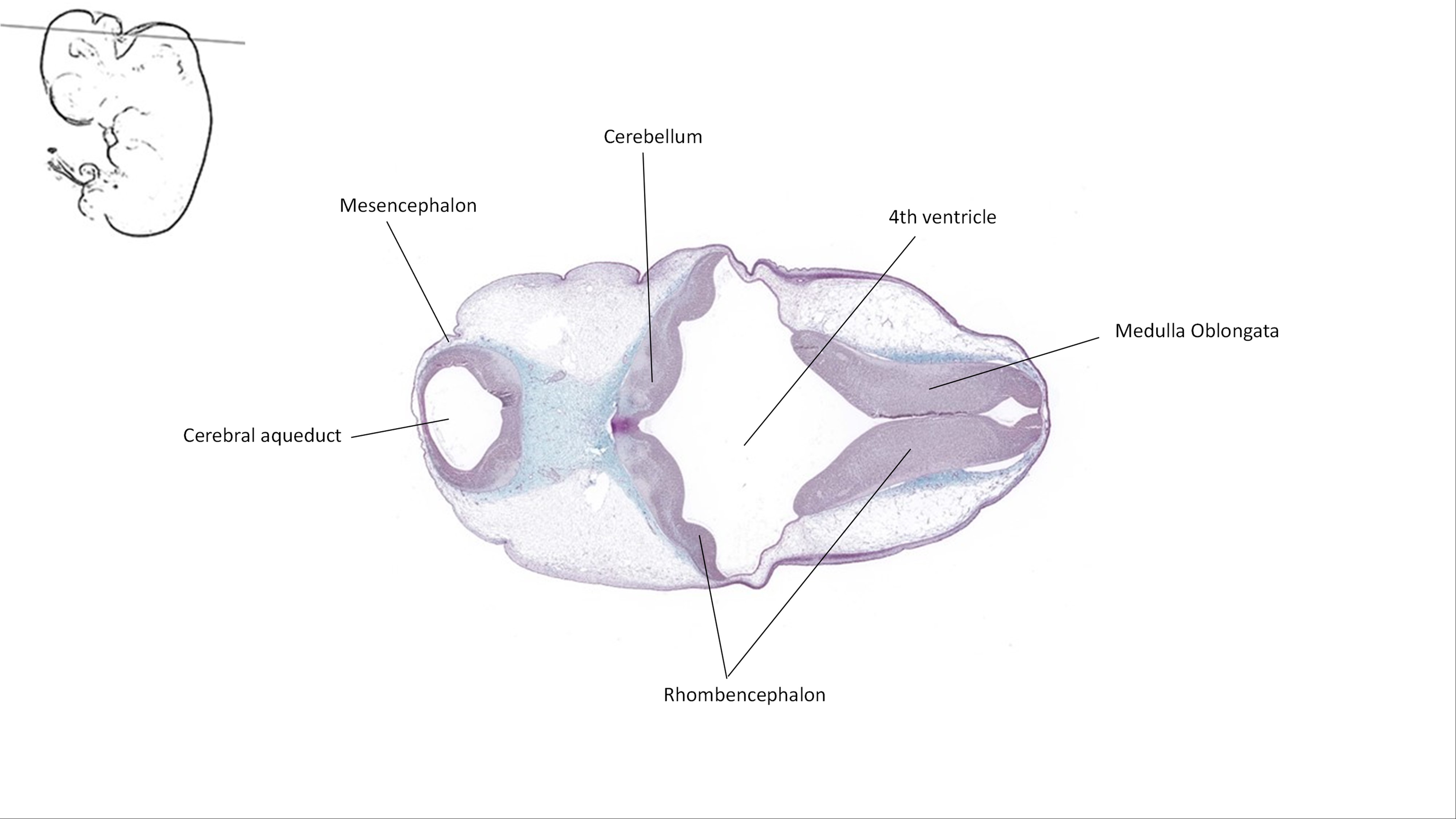 A histology section of a human embryo