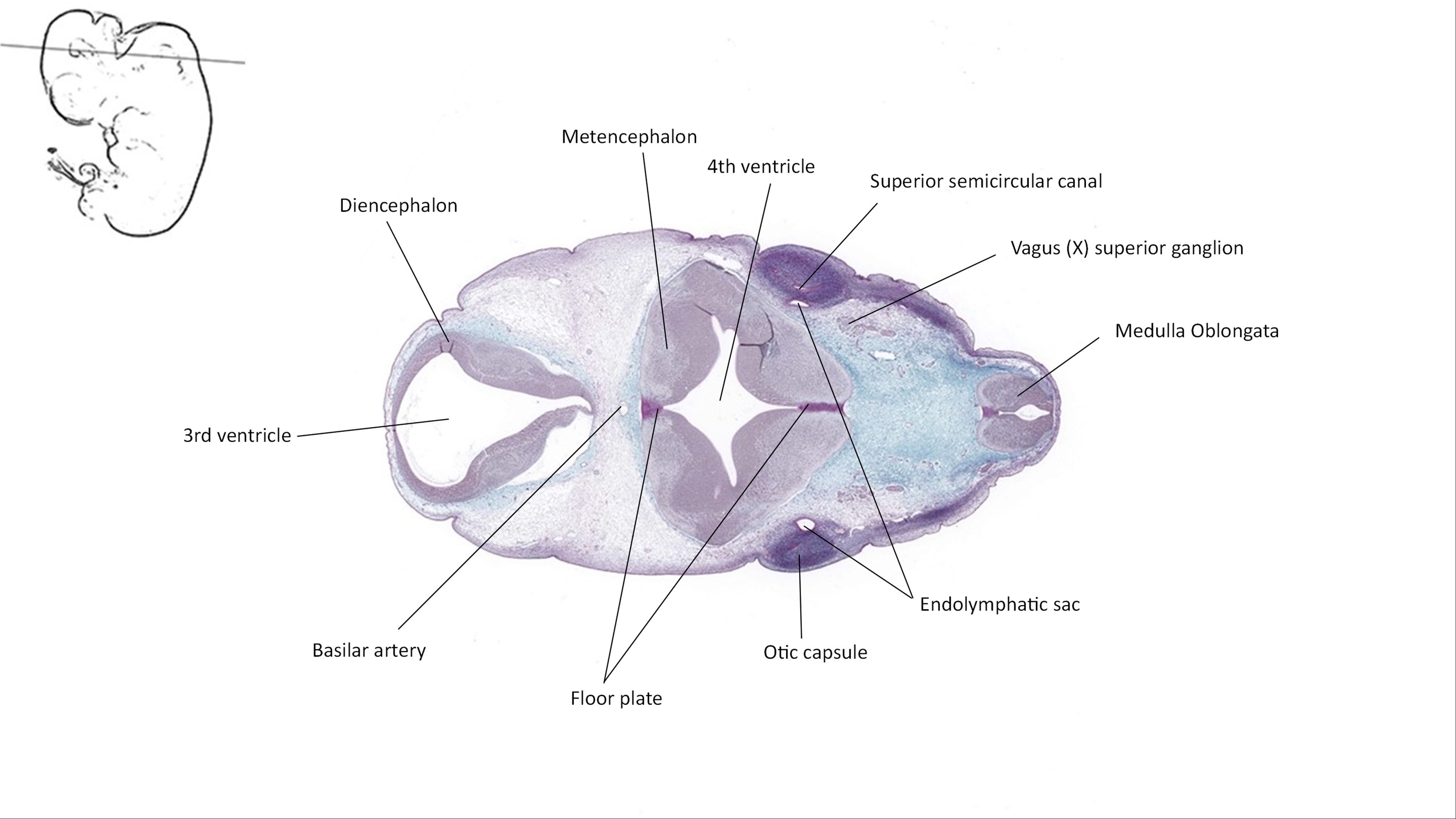 A histology section of a human embryo