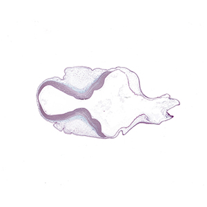 A histology section of a human embryo