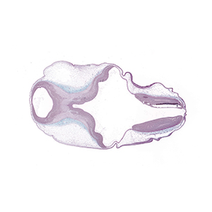 A histology section of a human embryo