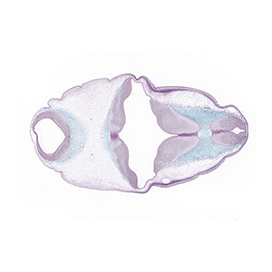 A histology section of a human embryo