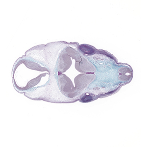 A histology section of a human embryo