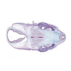 A histology section of a human embryo