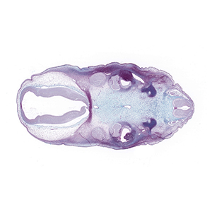 A histology section of a human embryo