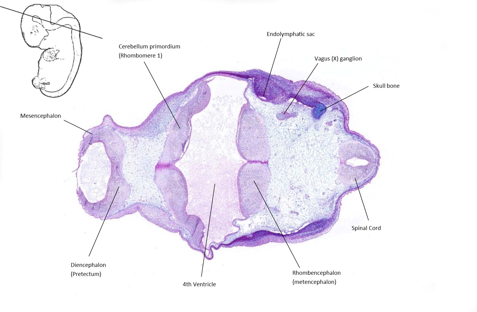 A histology section of a human embryo