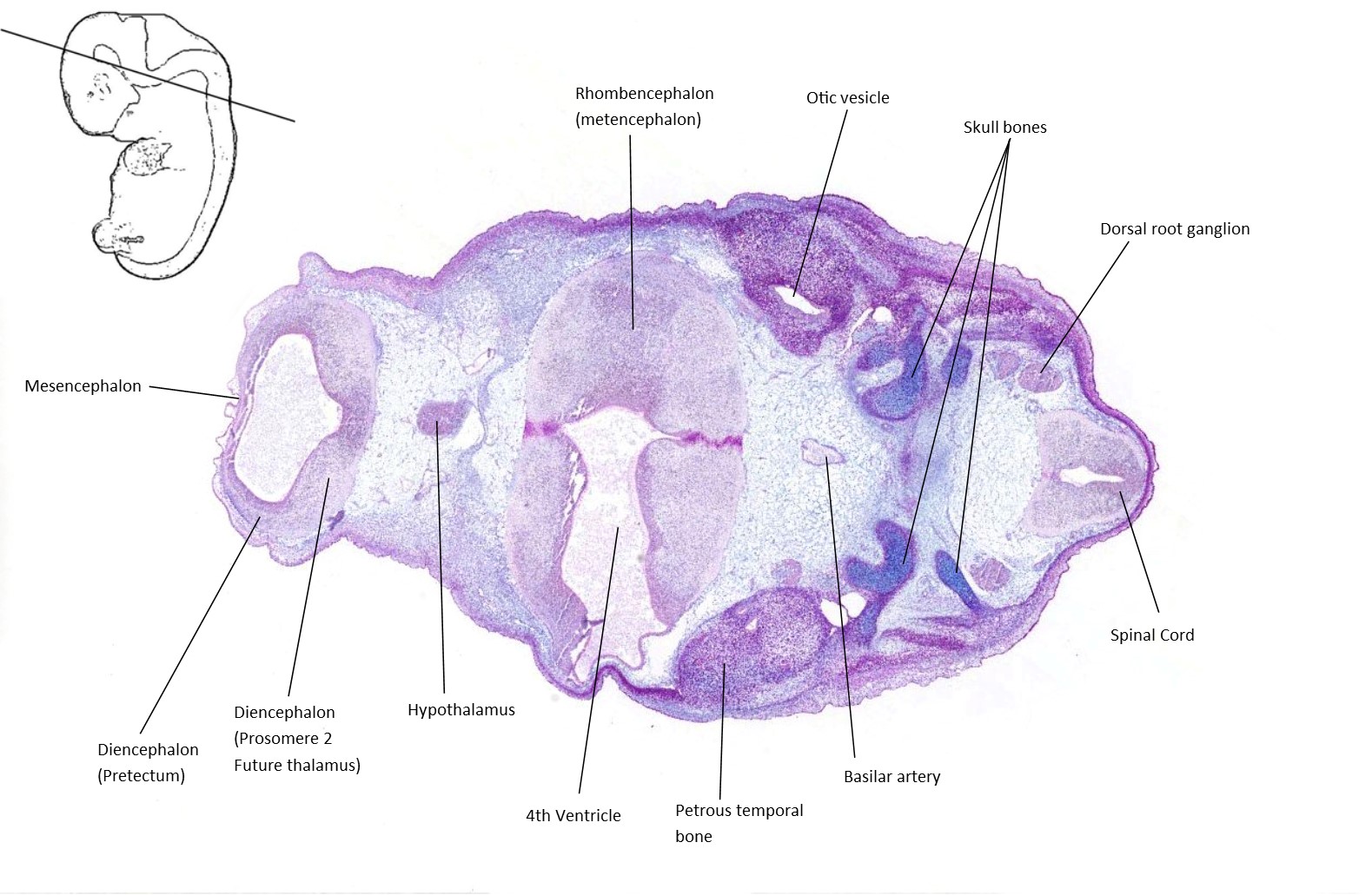 A histology section of a human embryo