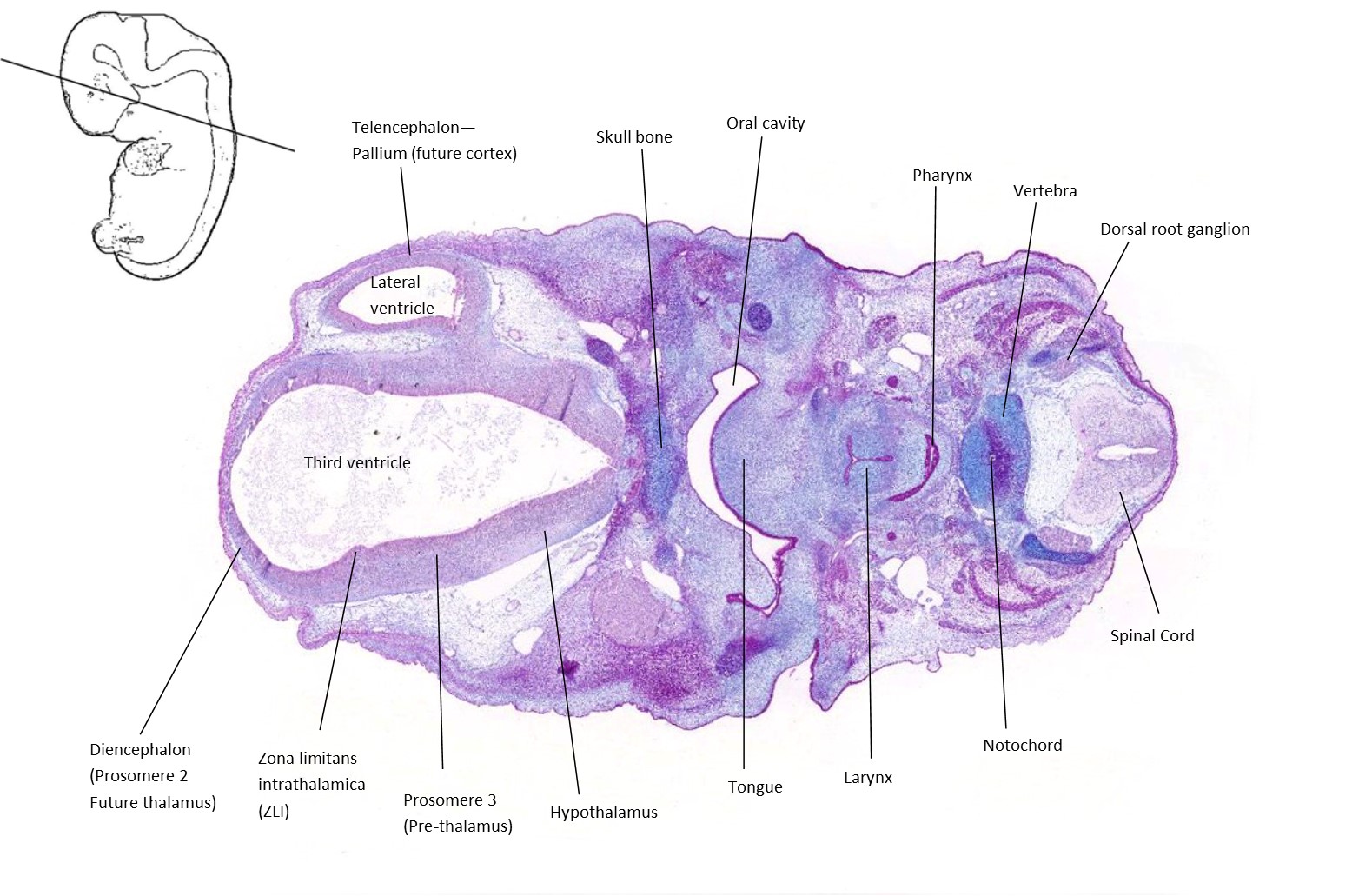 A histology section of a human embryo