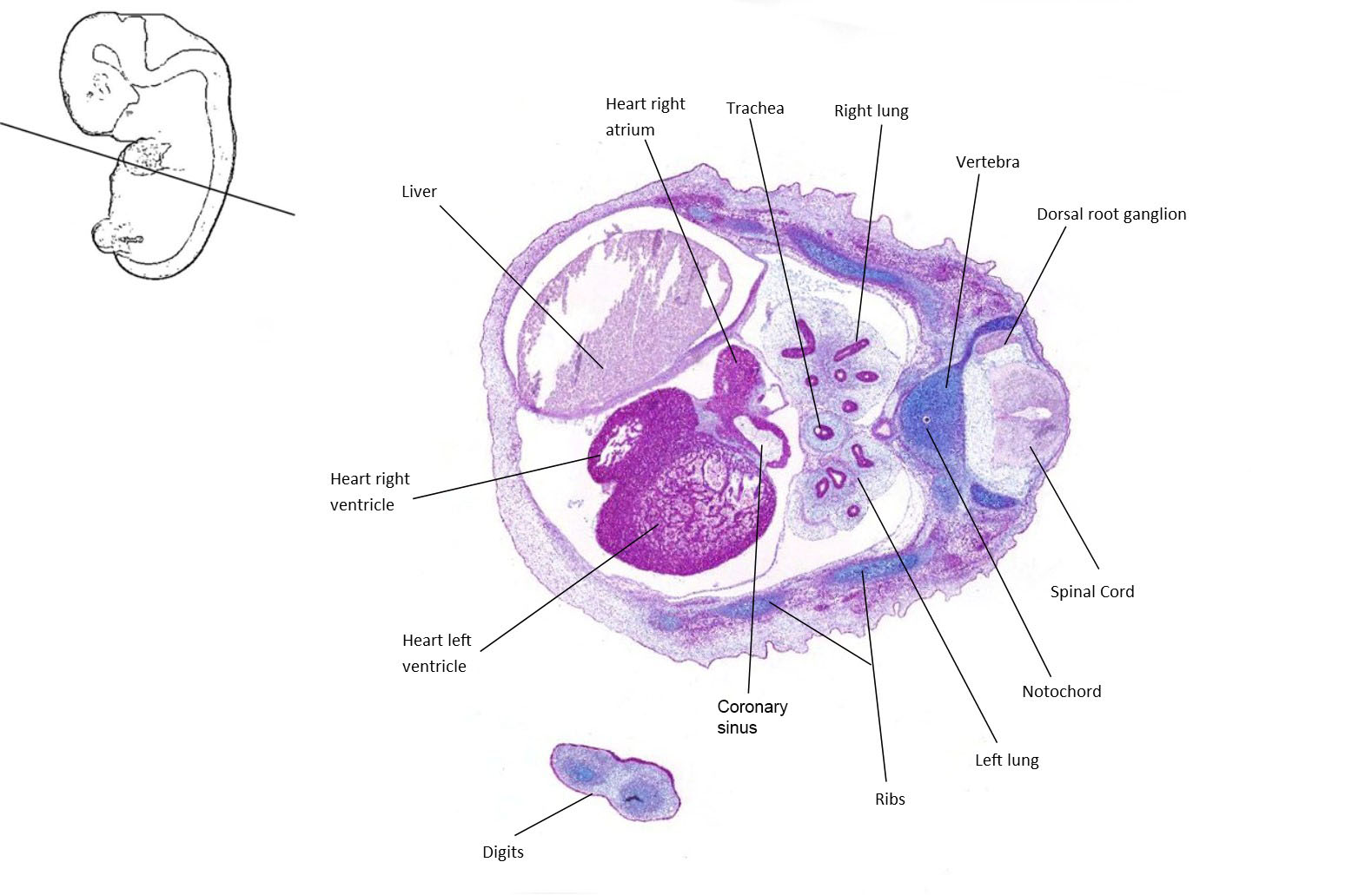 A histology section of a human embryo