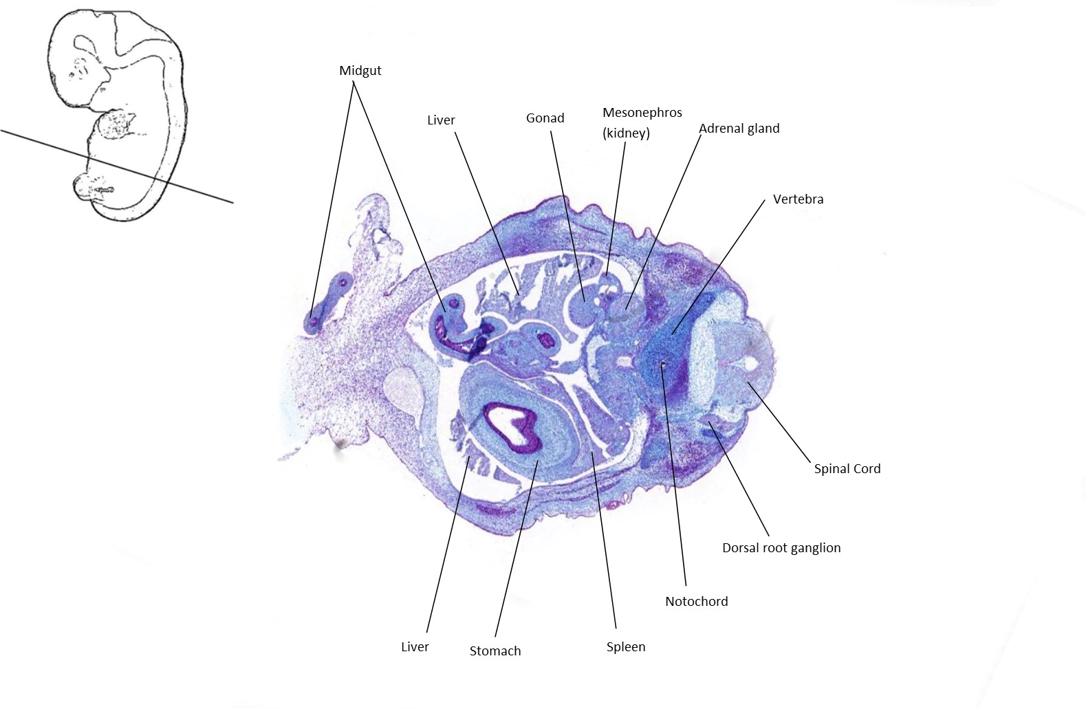 A histology section of a human embryo