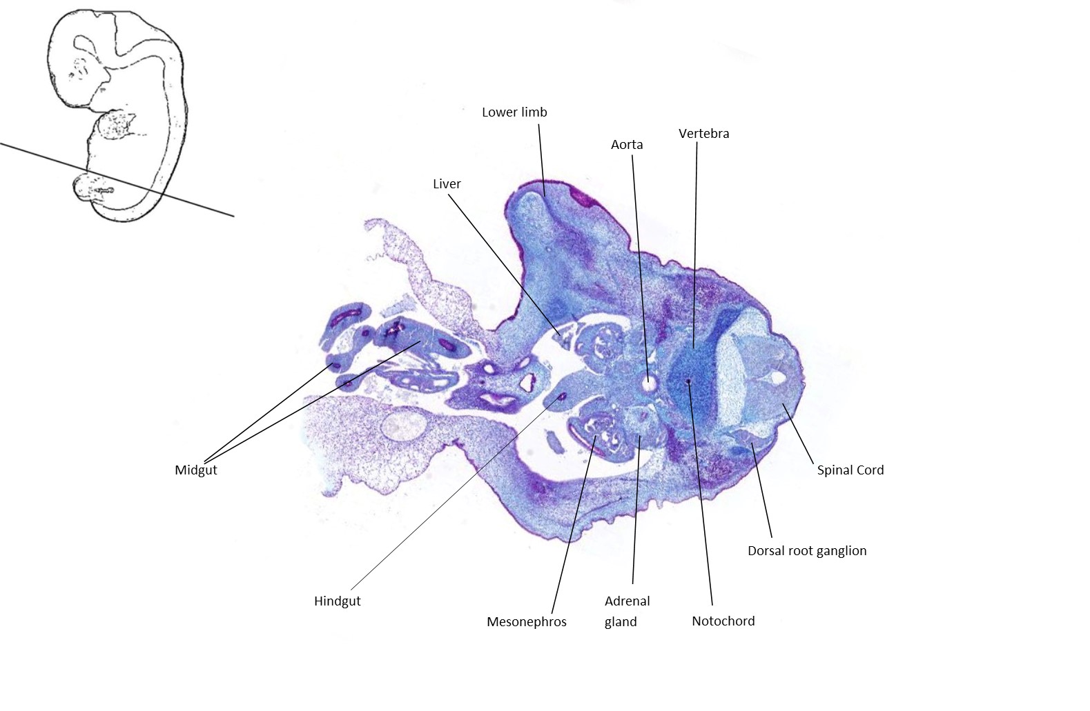A histology section of a human embryo