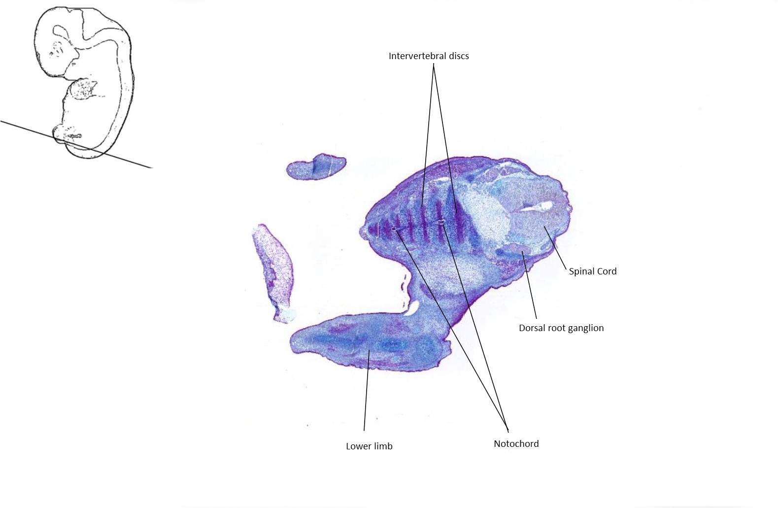 A histology section of a human embryo