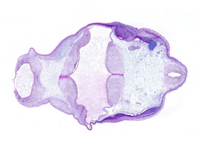 A histology section of a human embryo