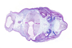 A histology section of a human embryo