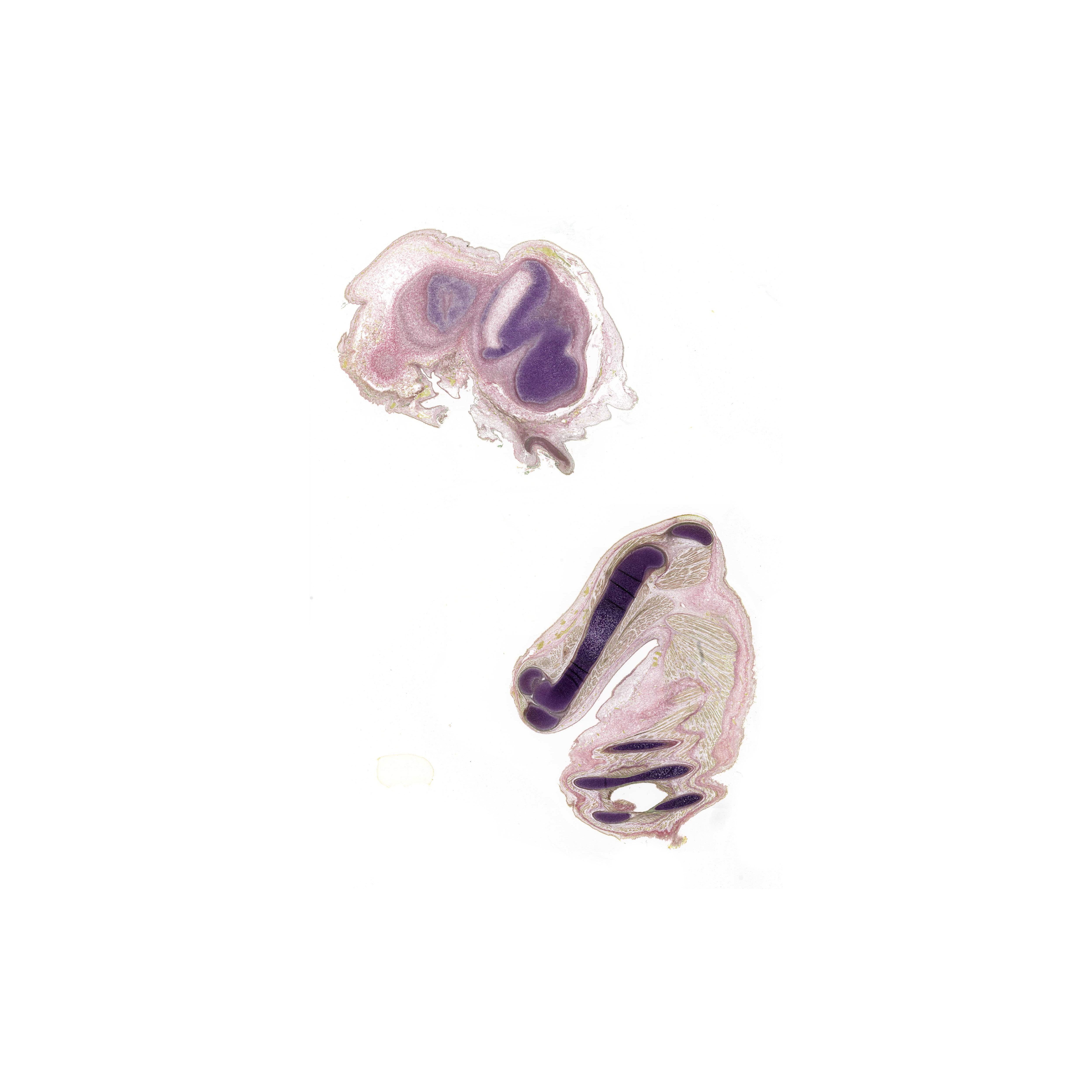 A pentachrome stained section of a human embryo
