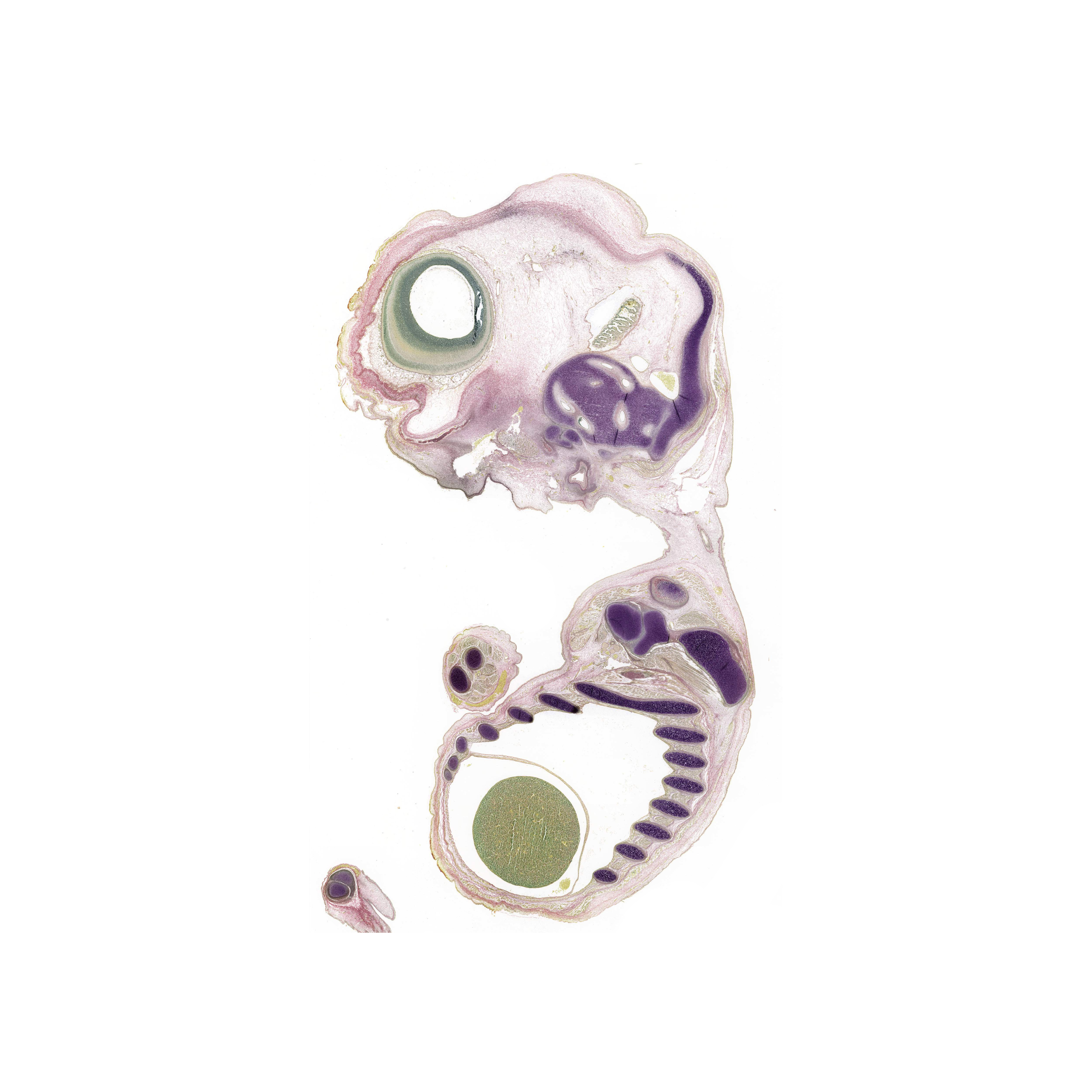 A pentachrome stained section of a human embryo