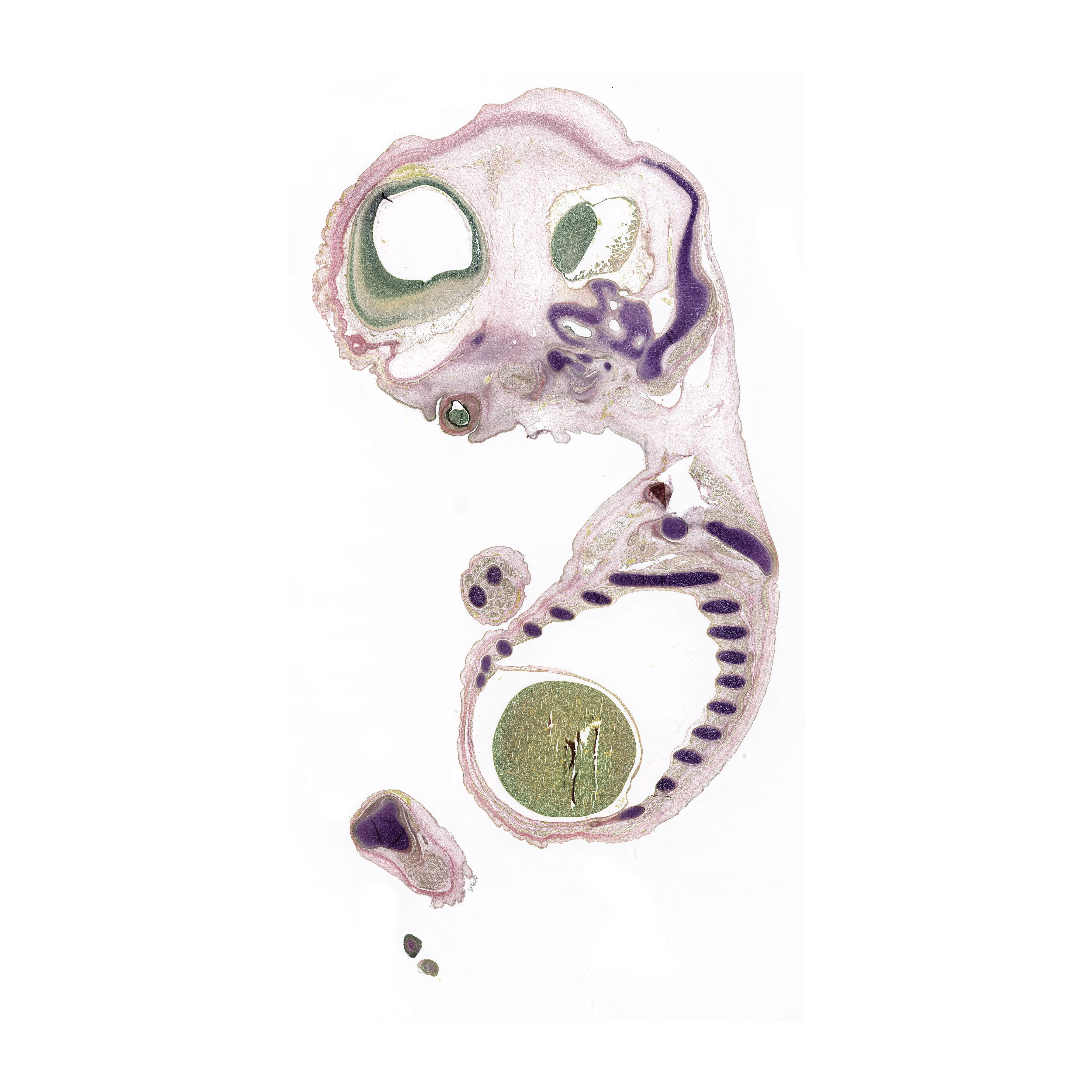 A pentachrome stained section of a human embryo