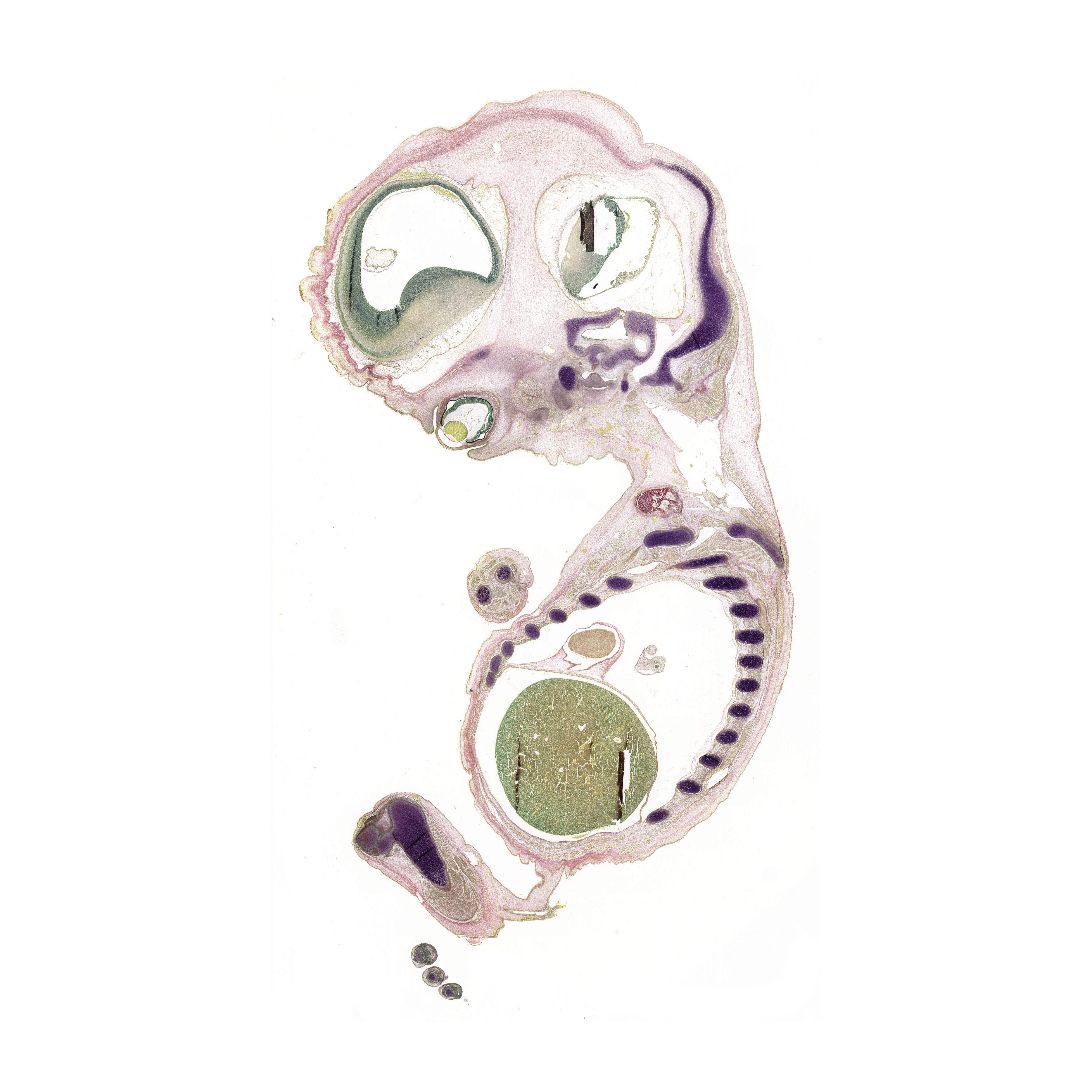 A pentachrome stained section of a human embryo