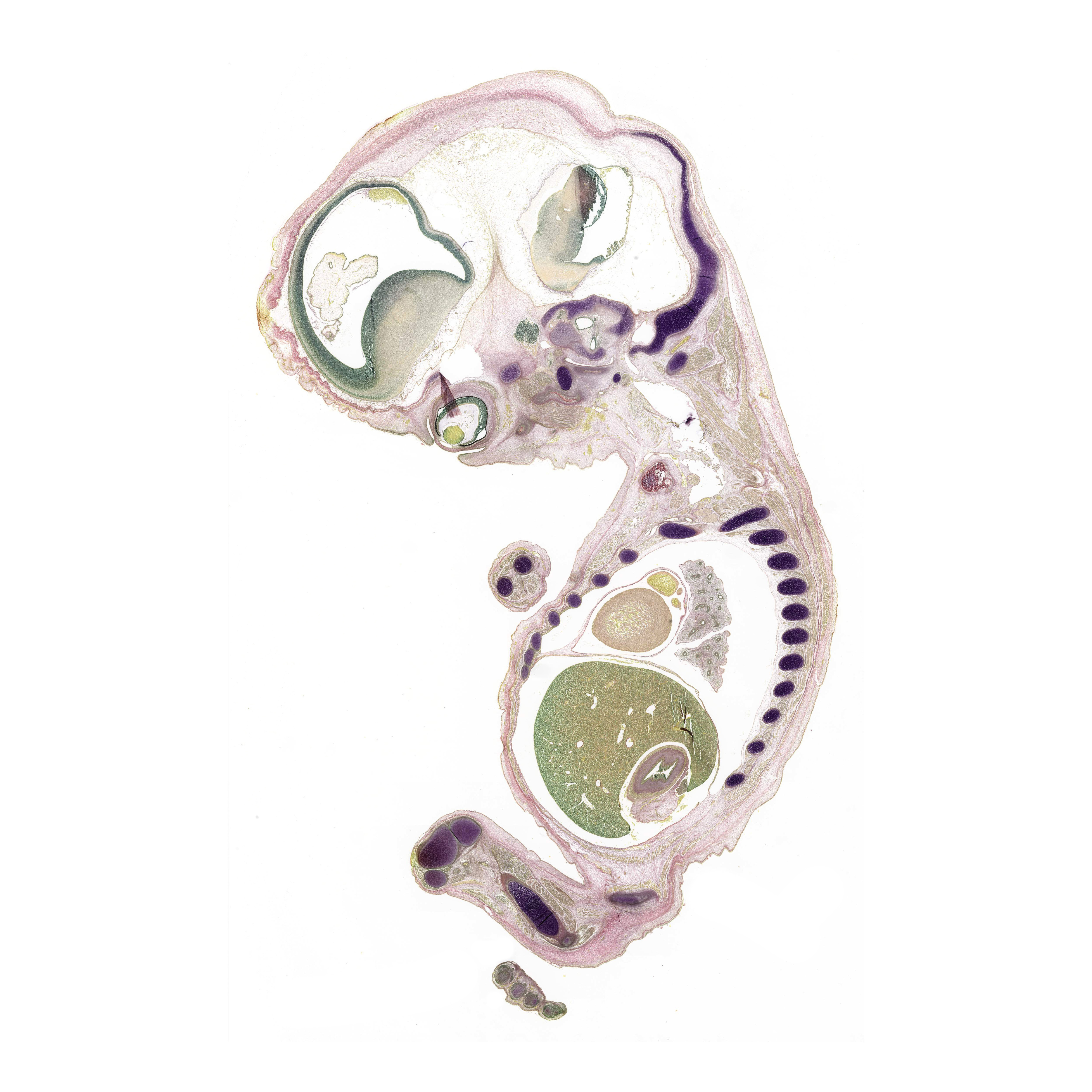 A pentachrome stained section of a human embryo