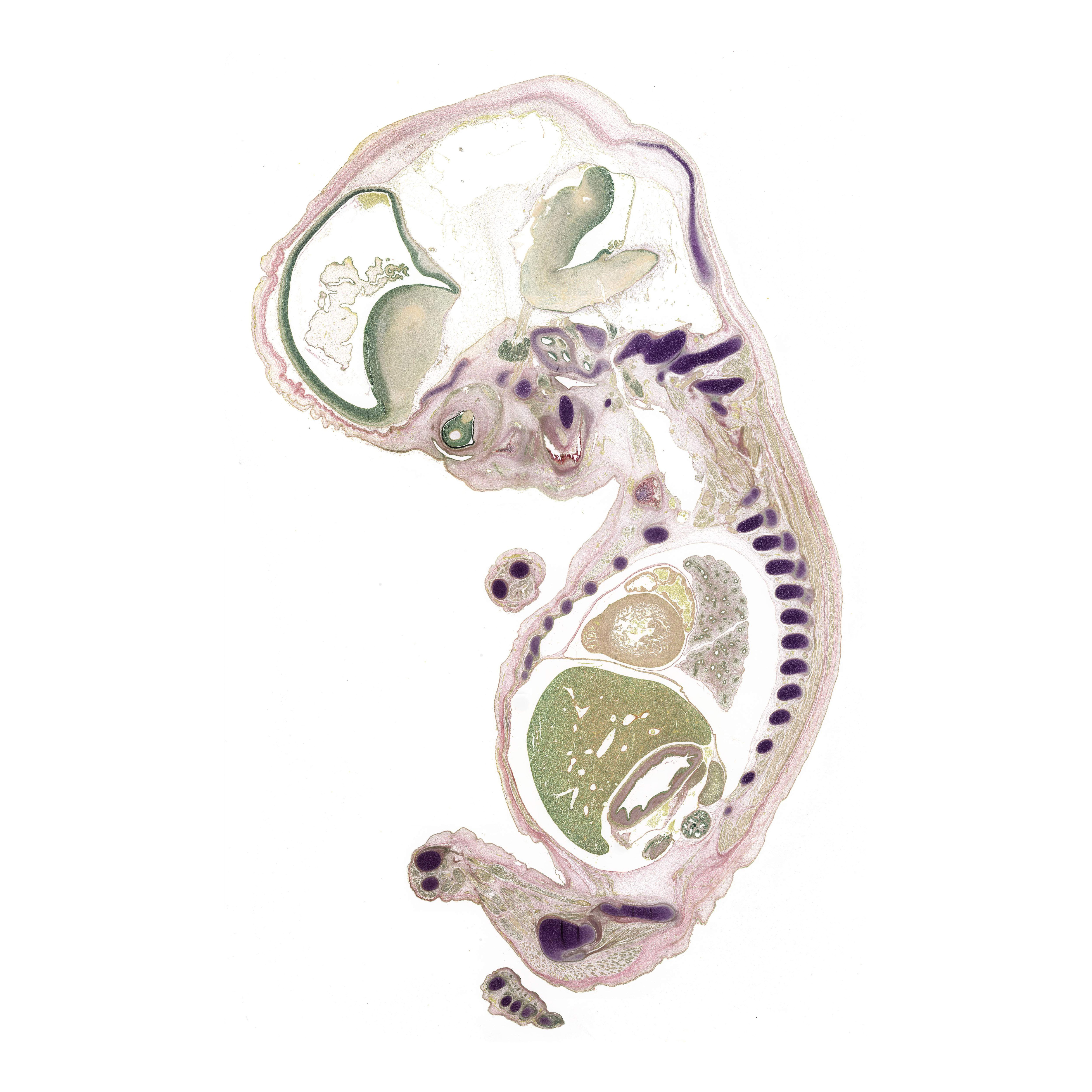 A pentachrome stained section of a human embryo