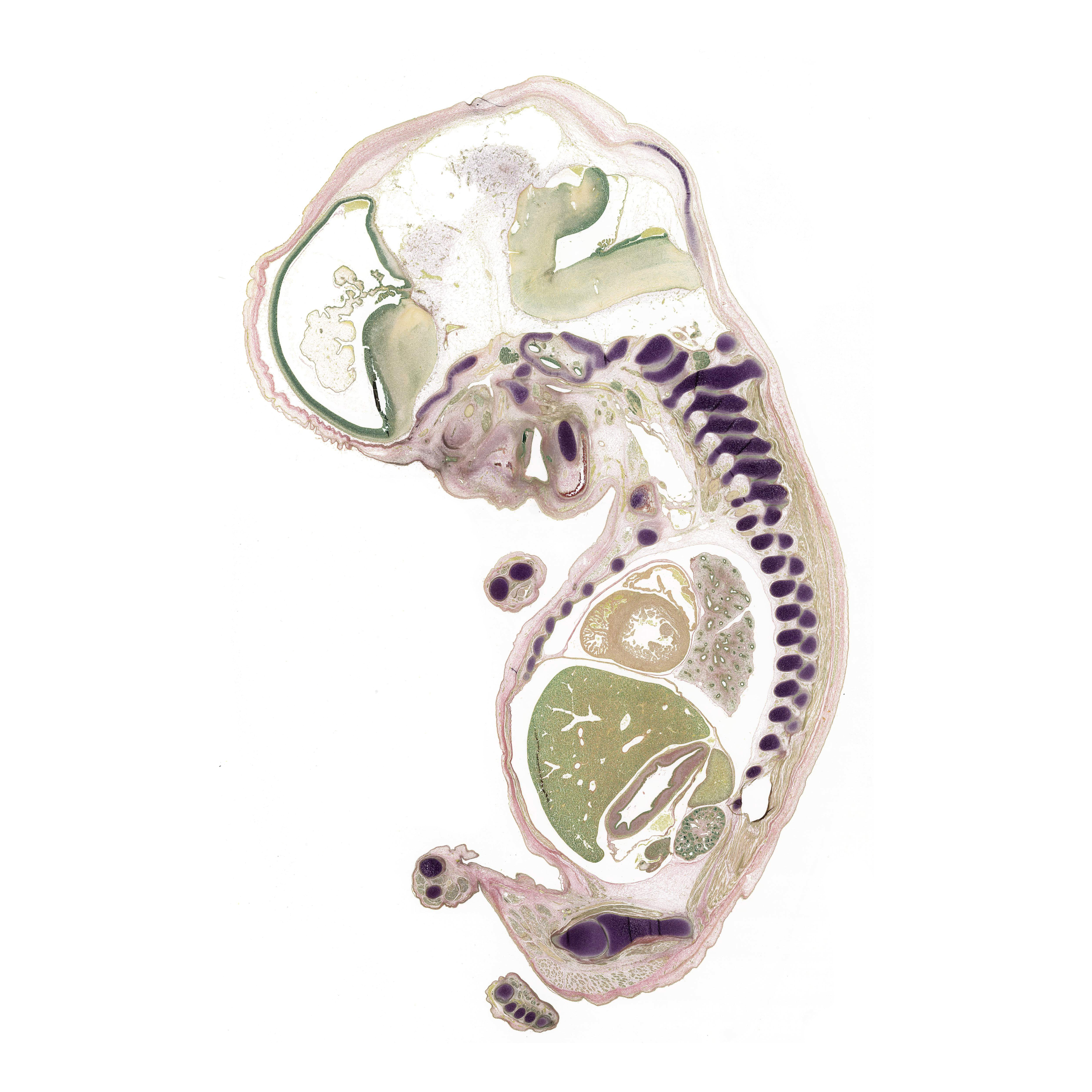 A pentachrome stained section of a human embryo