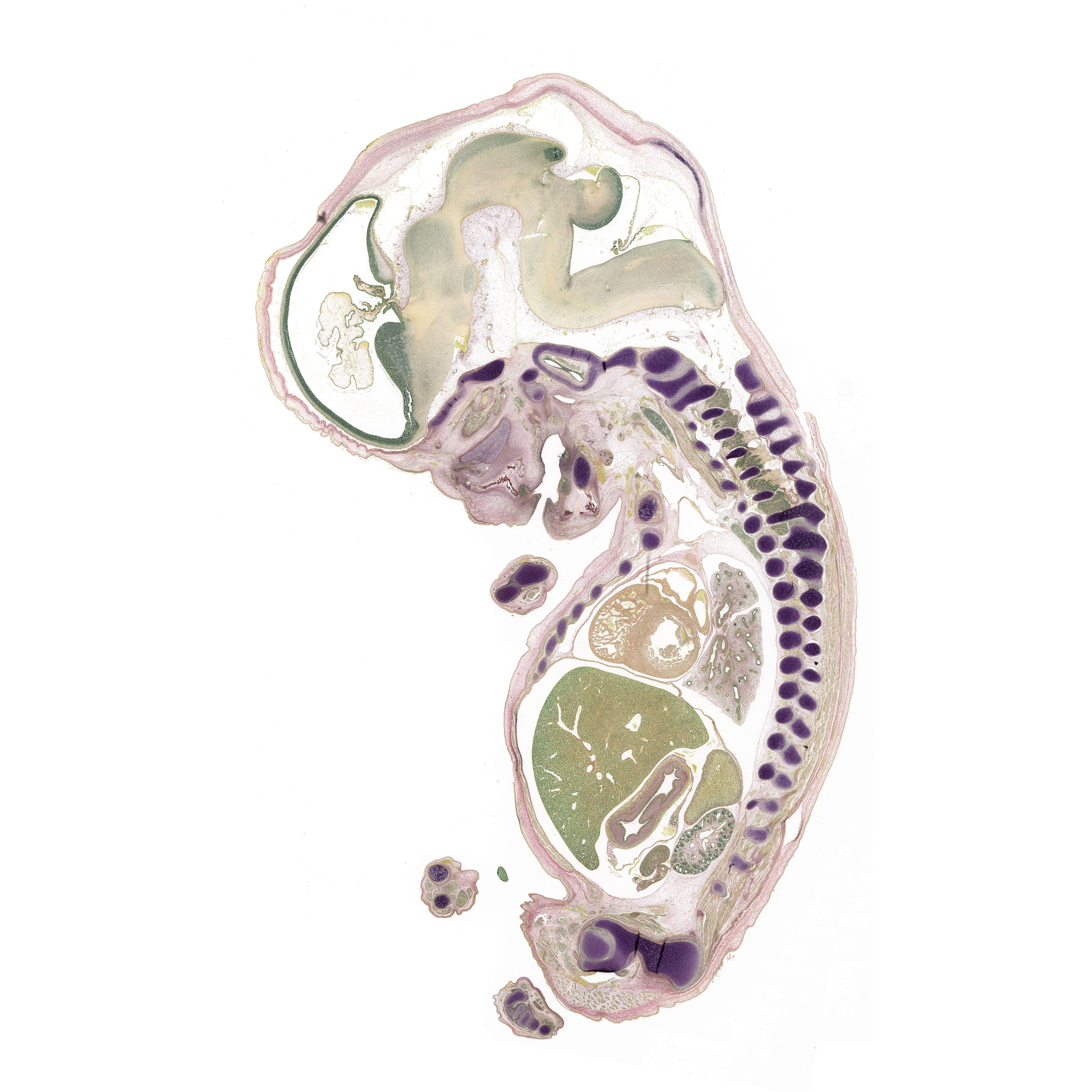 A pentachrome stained section of a human embryo