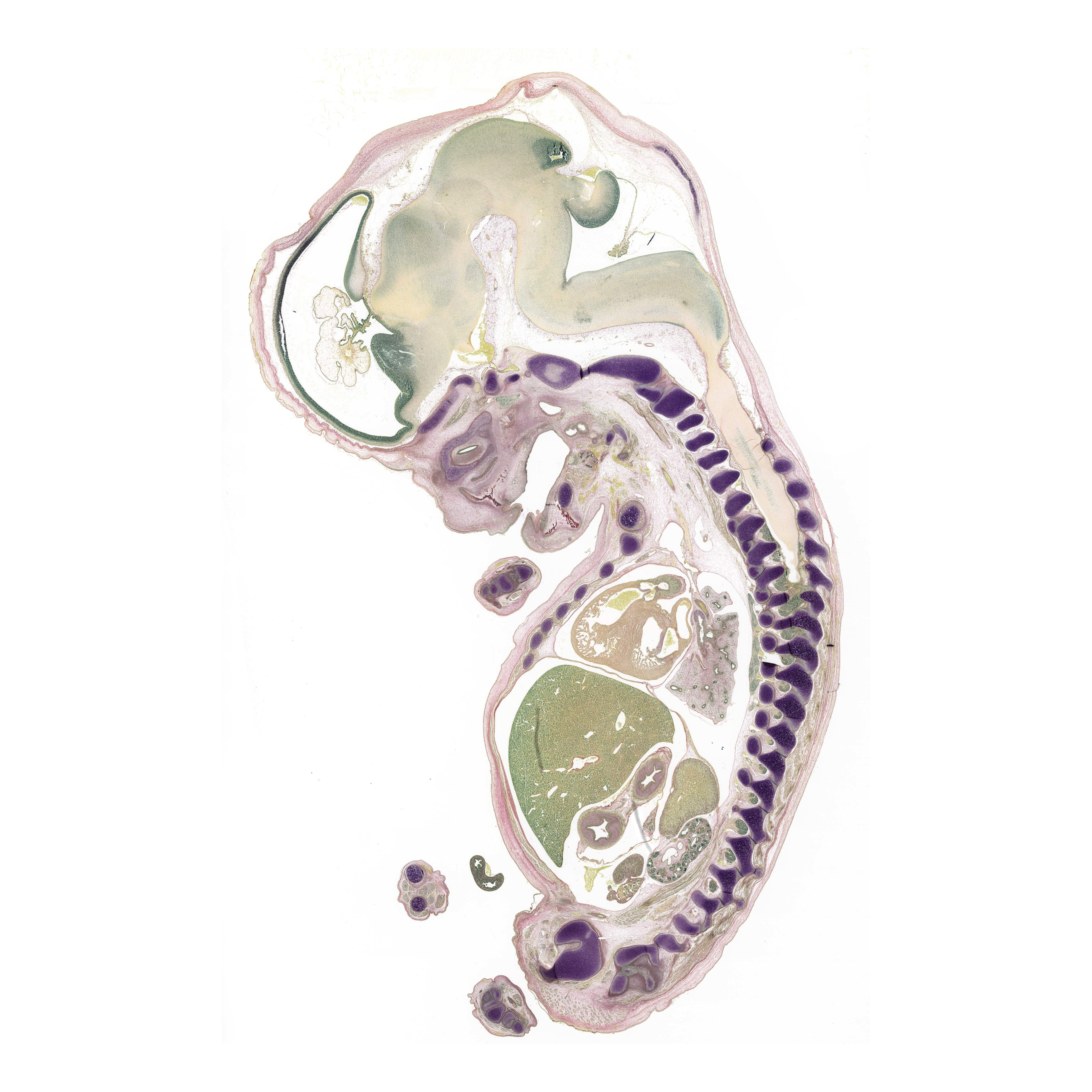 A pentachrome stained section of a human embryo