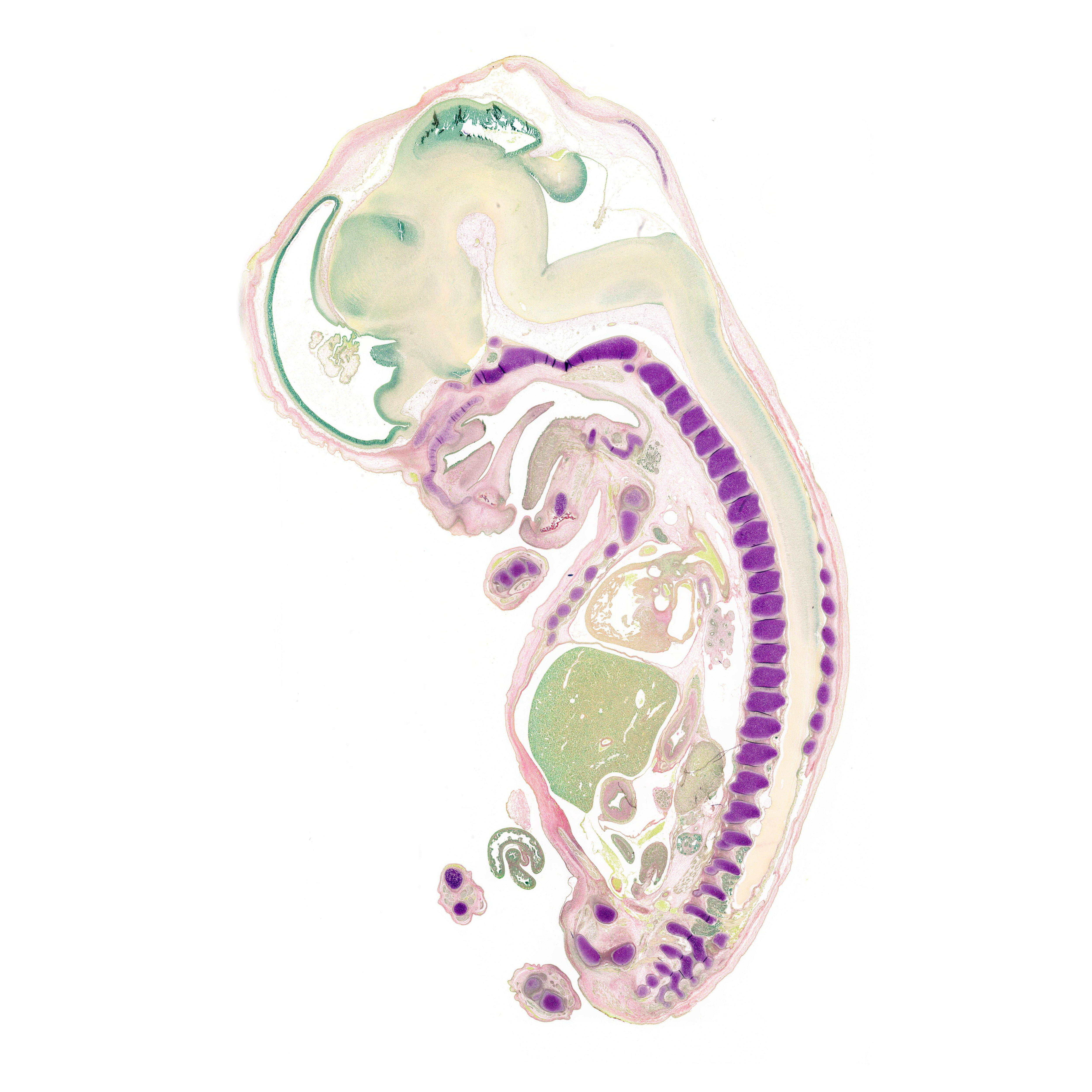 A pentachrome stained section of a human embryo