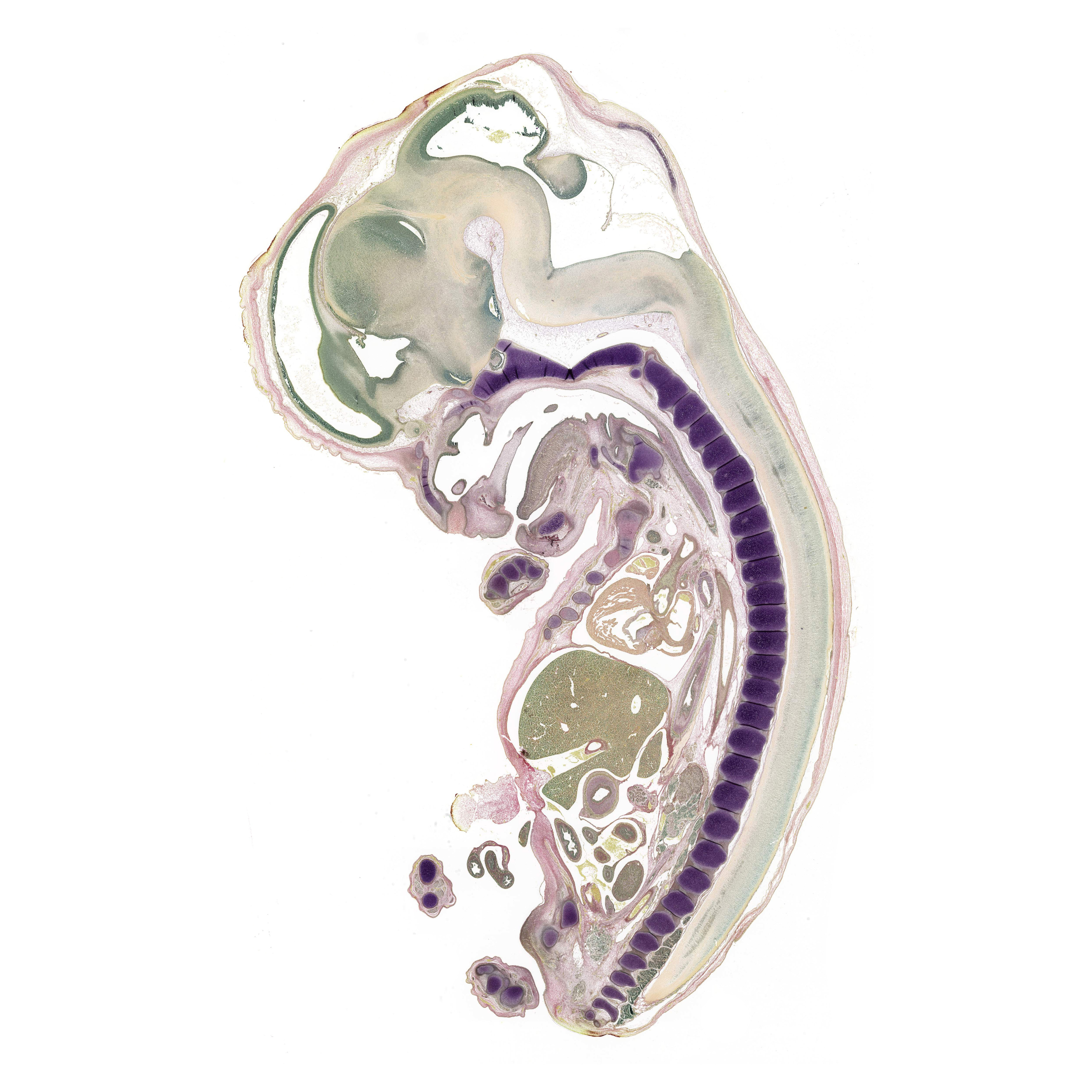 A pentachrome stained section of a human embryo