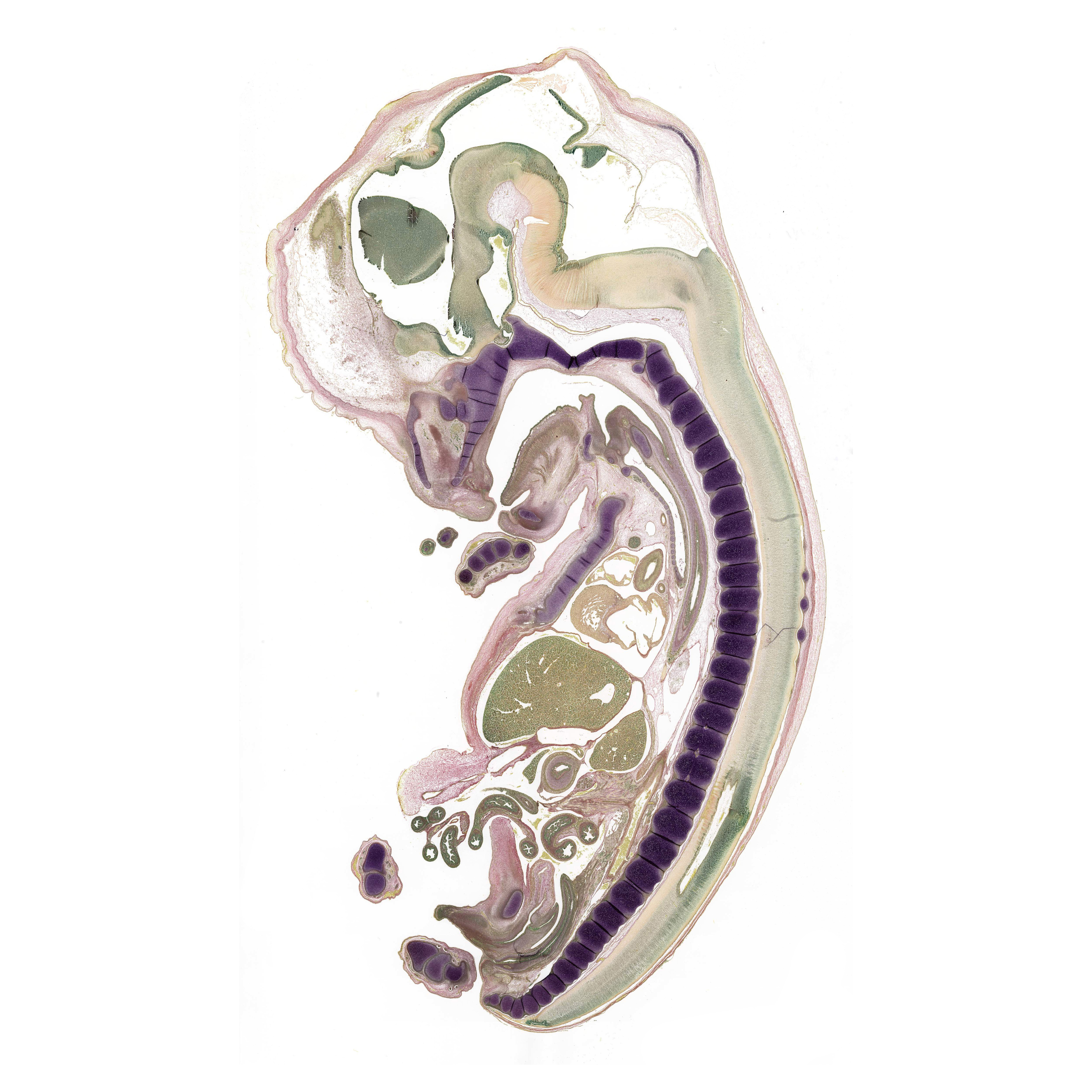 A pentachrome stained section of a human embryo