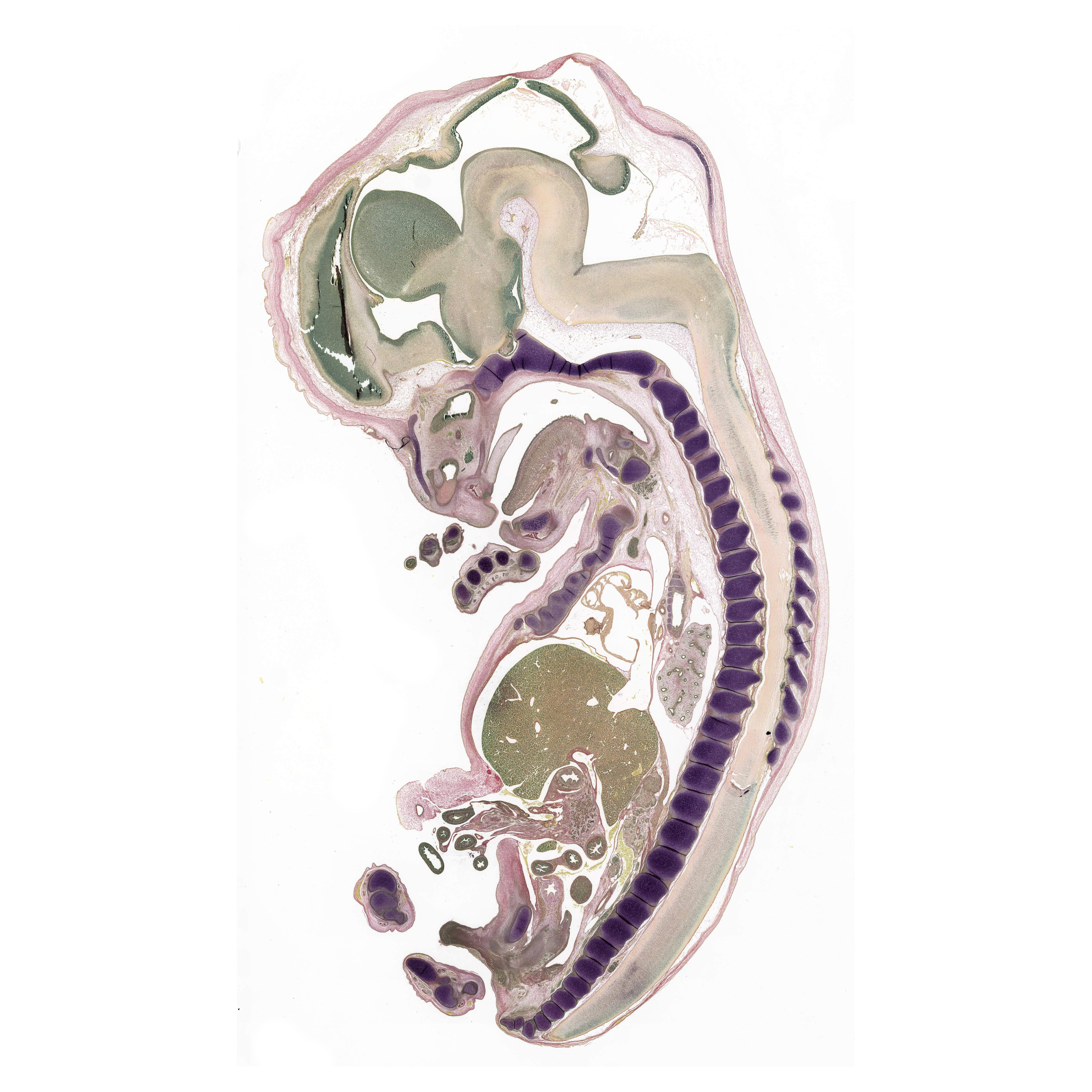 A pentachrome stained section of a human embryo