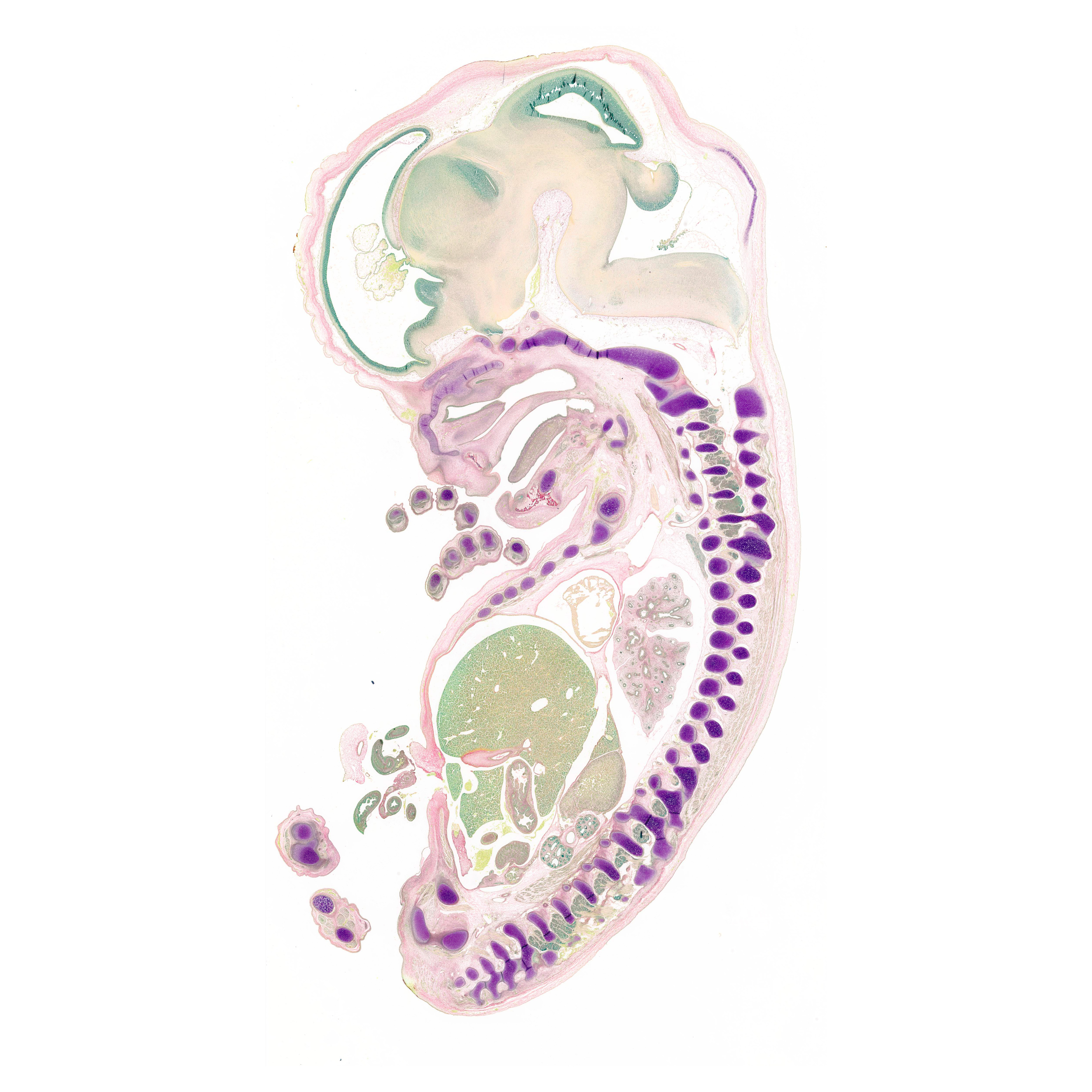 A pentachrome stained section of a human embryo